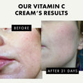 Vitamin C Moisturizer for Face with Hyaluronic Acid & Squalane - Face Brightening Cream - anti Aging, Firming & Hydrating Moisturizer for All Skin