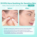 Face Towels, 10"ÃÂ12" Disposable Face Towel, Face Towelettes XL, Ultra Soft Makeup Remover Dry Wipes, Thick Face Towel for Sensitive Skin, 50 Count