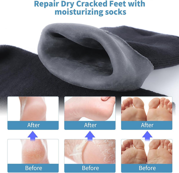 11" Large Silicone Moisturizing Socks for Men - 2 Pairs Soft Foot Care Socks - Feet Moisturizing Socks for Dry Cracked Feet (Size L) 2 pairs black L