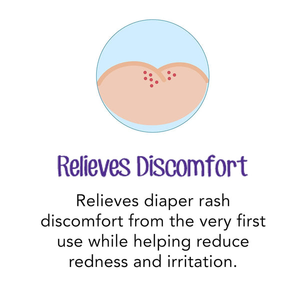 Desitin Daily Defense Baby Diaper Rash Cream with Zinc Oxide to Treat, Relieve & Prevent diaper rash, Hypoallergenic, Dye-, Phthalate- &