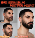 5% Minoxidil Beard Growth Oil for Men: Minoxidil for Men Beard Hair Regrowth Serum with Biotin and Caffeine - Unleash Your Wildness with Stronger