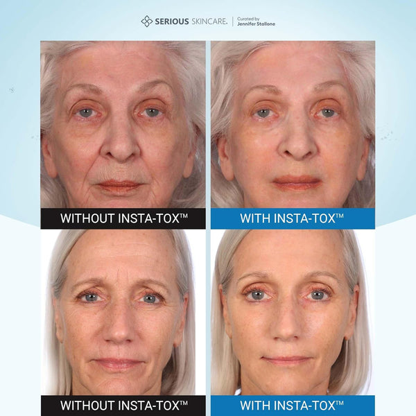 Serious Skincare - INSTA-TOX Instant Line and Wrinkle Filler Face Serum - Firm and Smooth Fine Lines, Deep Wrinkles and Pores - Temporary Skin