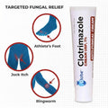 Globe Clotrimazole Antifungal Cream 1% USP (1 oz), Anti Fungal Treatment, Relieves Itching, Burning, Cracking and Scaling Associated Athletes