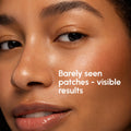 MAREE Invisible Pimple Patches for Face - Clear Zit Acne Patches - 72 Ct 72 Count (Pack of 1) Clear