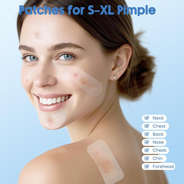 Pimple Patches for Face & Body,331 Patches Variety Pack w/ Large Sizes,Invisible Hydrocolloid Acne Patch with Tea Tree Oil & Salicylic