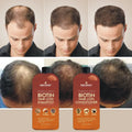 First Botany, Hair Growth Shampoo Conditioner Set - An Anti Hair Loss Biotin Shampoo & Conditioner with DHT blockers to fight Hair Loss For Men &