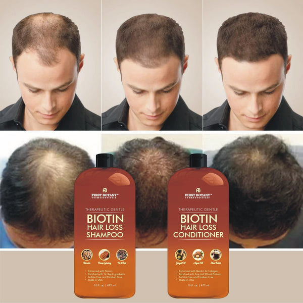 First Botany, Hair Growth Shampoo Conditioner Set - An Anti Hair Loss Biotin Shampoo & Conditioner with DHT blockers to fight Hair Loss For Men &