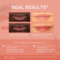 Hanalei Hydrating Lip Treatment Balm â Cruelty-Free, Paraben-Free Moisturizer for Severely Dry, Chapped Lips â Kukui Oil, Shea Butter & Grapeseed