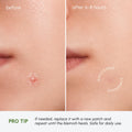 MAREE Invisible Pimple Patches for Face - Clear Zit Acne Patches - 72 Ct 72 Count (Pack of 1) Clear