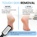Colossal Foot rasp Foot File and Callus Remover. Best Foot Care Pedicure Metal Surface Tool to Remove Hard Skin. Can be Used on Both Wet and Dry