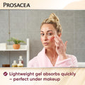 Prosacea - Medicated Rosacea Treatment for Face - Heals Rosacea Symptoms of Redness, Pimples and Irritation - Fragrance Free - 0.75 oz Pack of 1