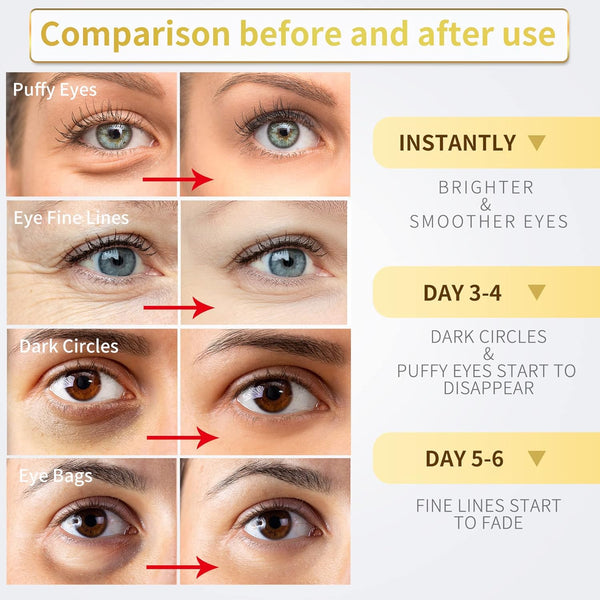 Under Eye Patches - 60 Pcs - 24K Gold Eye Mask- Puffy Eyes & Dark Circles Treatments,Reduce under Eye Bags and Smooth Wrinkles,Eye Skin Care Pads