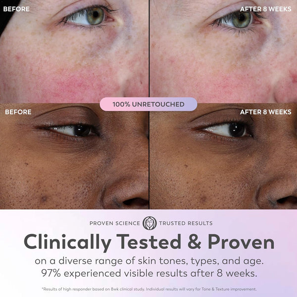 Olay Super Serum - Glow Serum for Face - Activated Niacinamide, Vitamin C & E, Collagen Peptide, AHA - 5-in-1 Benefits - Brightens, Hydrates,