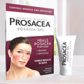 Prosacea - Medicated Rosacea Treatment for Face - Heals Rosacea Symptoms of Redness, Pimples and Irritation - Fragrance Free - 0.75 oz Pack of 1