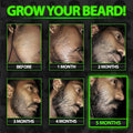 Beard Growth Serum - GROW Maximum XXL Beard Growth Oil for Men -Thickens & Fills Patches - Facial Hair & Scalp Treatment - Beard & Hair Thickening