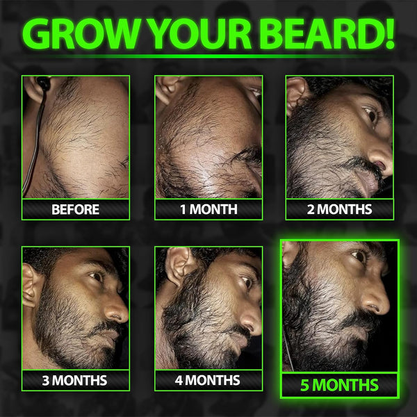 Beard Growth Serum - GROW Maximum XXL Beard Growth Oil for Men -Thickens & Fills Patches - Facial Hair & Scalp Treatment - Beard & Hair Thickening