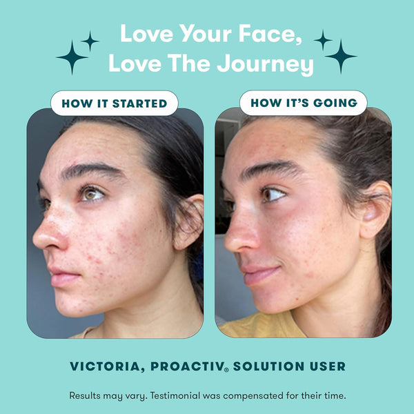 Proactiv 3 Step Acne Treatment - Benzoyl Peroxide Face Wash, Repairing Acne Spot Treatment for Face and Body, Exfoliating Toner - 30 Day Complete
