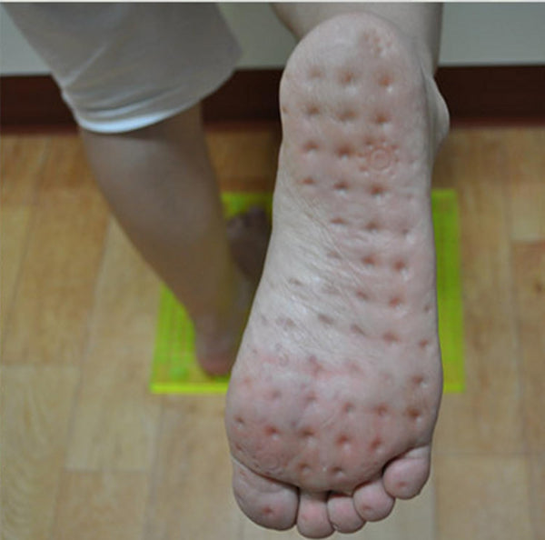 Reflexology Foot Massage Mat Stimulates Blood Circulation Acupressure Feet Massager Plate Board with Magnet (2. Foot Shape Mat)