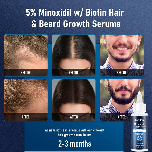 5% Minoxidil for Men & Women Hair with Biotin, Minoxidil for Men Beard,Tecflox Minoxidil Beard Growth Oil, Minoxidil Hai