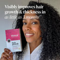 Viviscal Hair Growth Supplements for Women, Thicker Fuller Hair Support for Thinning Hair and Hair Loss, with Biotin and Marine Collagen,
