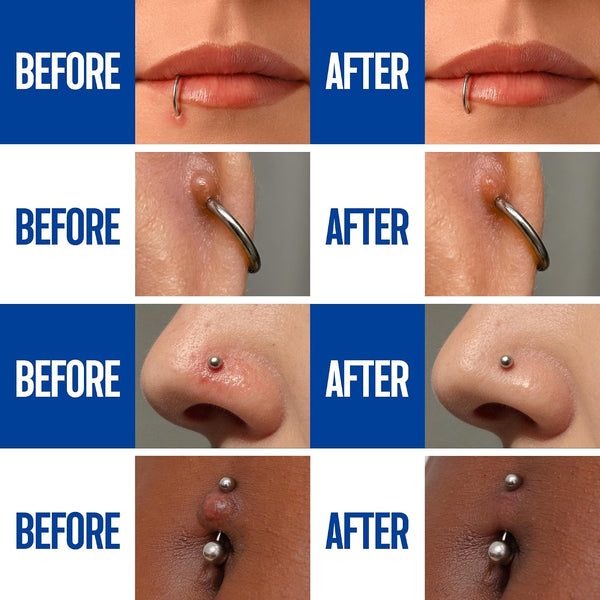BodyJ4You Piercing Aftercare Spray - Saline Solution for Piercings Wound Wash Sterile Saline - Keloid Bump Removal Ear Nose Septum Belly Button