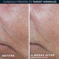 RoC Derm Correxion Retinol Firming Serum Stick with Antioxidants to Visibly Tighten and Firm Wrinkles and Laugh Lines For Men and Women + Retinol