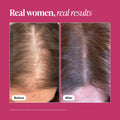 Viviscal Hair Growth Supplements for Women, Thicker Fuller Hair Support for Thinning Hair and Hair Loss, with Biotin and Marine Collagen,