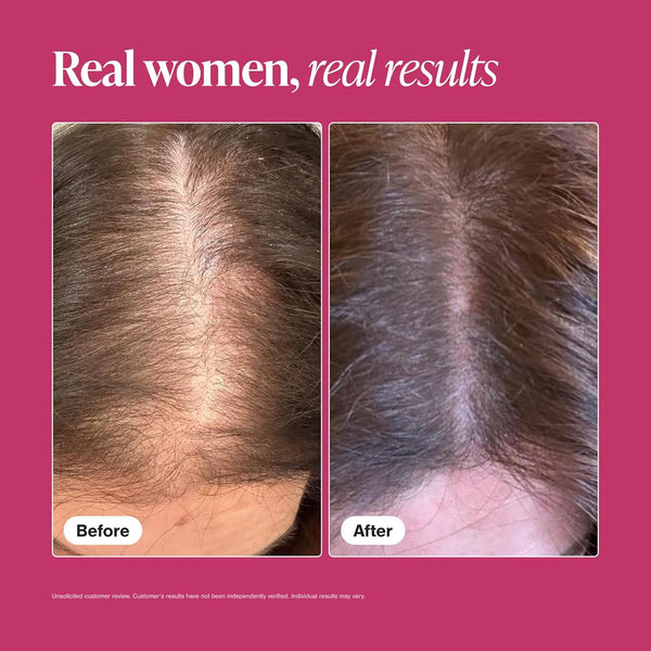 Viviscal Hair Growth Supplements for Women, Thicker Fuller Hair Support for Thinning Hair and Hair Loss, with Biotin and Marine Collagen,