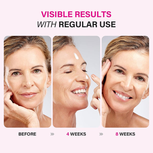 Face Moisturizer for Aging Skin: Wrinkle Cream for Older Women and Men 50 and 60 plus with Retinol, Collagen and Hyaluronic Acid – Facial