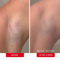 First Aid Beauty - Ingrown Hair Pads with BHA + AHA - Aftershave Treatment Pads to Help Prevent Razor Bumps for Men & Women - Exfoliate Underarms