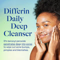 Differin Acne Face Wash, 5% Benzoyl Peroxide Daily Cleanser, 4oz | Gentle Acne Cleanser, Clears Breakouts, Sensitive Skin Safe, Benzoyl Peroxide