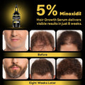 5% Minoxidil with Rosemary and Biotin for Men and Women Hair Growth,Beard Growth Kit,Scalp Serum for Thicker Fuller Hair 2 Fl Oz (Pack of 2)