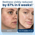 Clean Skin Club Clean Towels XL®, 100% USDA Biobased Face Towel, Disposable Face Towelette, Eczema Association Accepted, Makeup Remover Dry Wipes,
