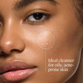 Neutrogena Oil-Free Facial Cleanser with Salicylic Acid for Acne-Prone Skin, 9.1 Fl. Oz