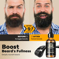 Waking Forest Derma Roller 0.25Mm & Beard Oil(1Oz), Sandalwood Beard Kit, Microneedle Beard Roller with 540 Titanium, Natural Moisturize with