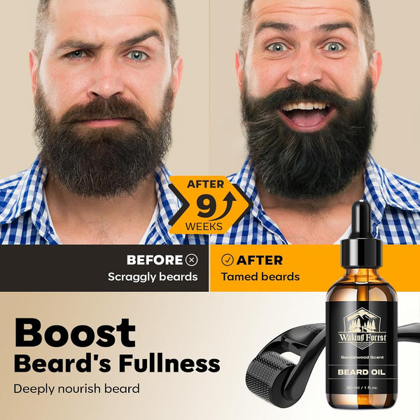 Waking Forest Derma Roller 0.25Mm & Beard Oil(1Oz), Sandalwood Beard Kit, Microneedle Beard Roller with 540 Titanium, Natural Moisturize with