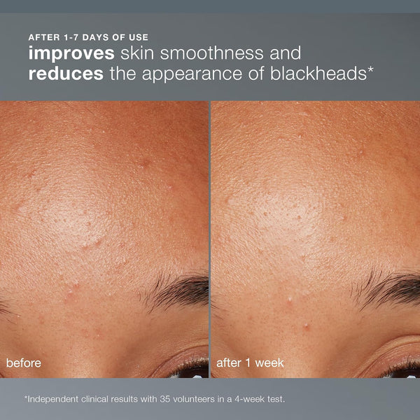 Dermalogica Daily Microfoliant, Face Exfoliator Scrub Powder with Salicylic Acid and Papaya Enzyme, Achieve Brighter, Smoother Skin Daily 0.45