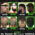 Beard Growth Serum - GROW Maximum XXL Beard Growth Oil for Men -Thickens & Fills Patches - Facial Hair & Scalp Treatment - Beard & Hair Thickening
