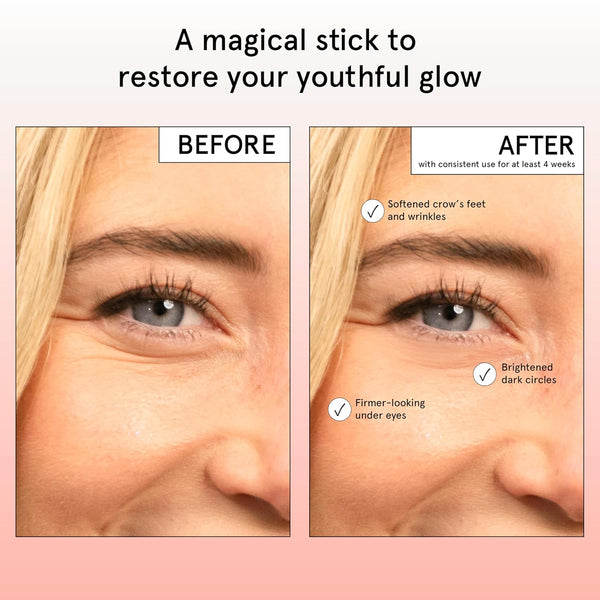 Grace & Stella under Eye Brightener Balm Stick - Caffeine Eye Cream for Dark Circles, Puffiness, Wrinkles - Moisturizer Stick with Niacinamide,