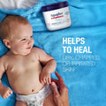 Aquaphor Healing Ointment, 14 Oz (396 G) 14 Ounce (Pack of 1)
