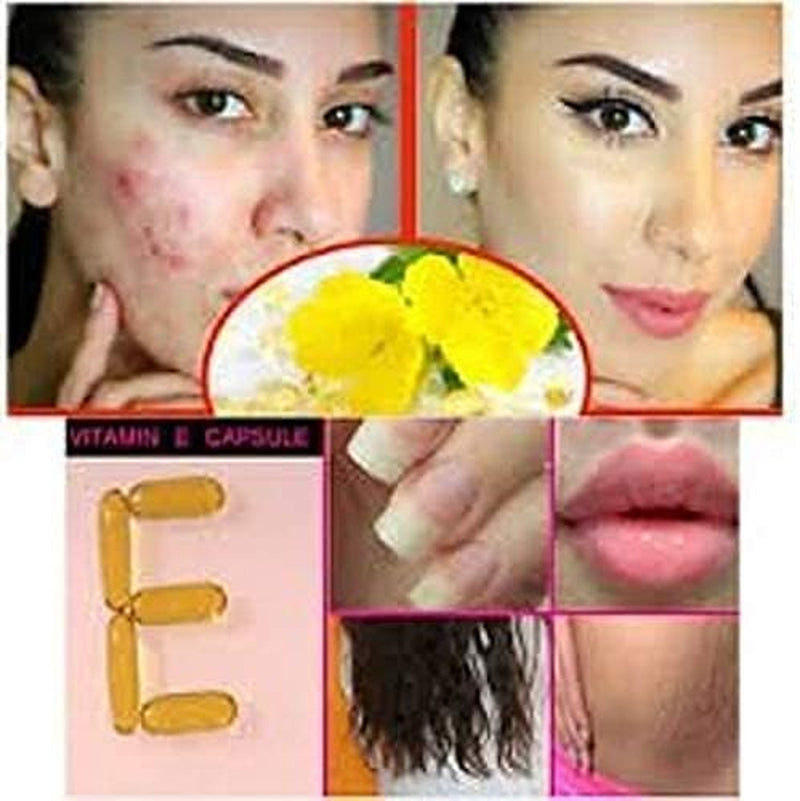 50 Evion Capsules Vitamin E for Glowing Face,Strong Hair,Acne,Nails, Glowing Skin 400Mg