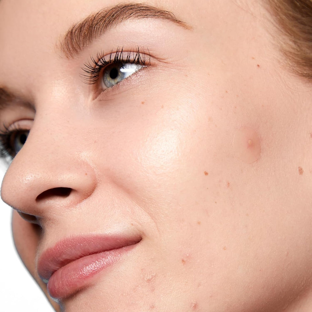 PEACE OUT Acne Day Dot, Sheer Acne Healing Dots, Virtually Invisible Wear, Hydrocolloid Pimple Patches Helps Clear Blemishes Quickly with Encapsulated Salicylic Acid, Retinol & Aloe Vera, 20 Dots