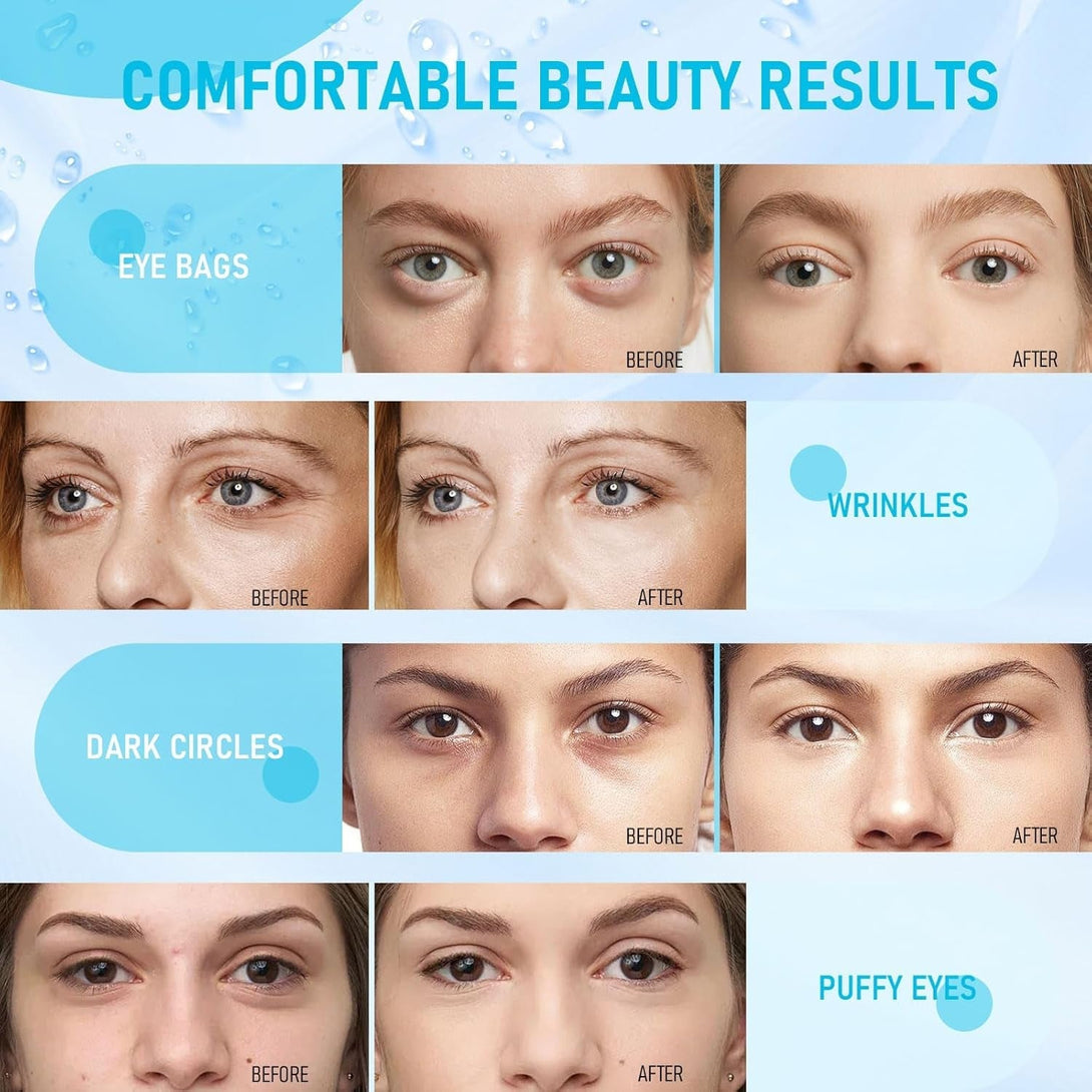 LAVONE under Eye Patches-30 Pairs Hydrating & Anti-Aging Eye Mask Skin Care for Dark Circles and Puffiness,Reduce Wrinkles,Eye Bags and Fine Lines,Eye Masks for Women and Man,With Hair Clips